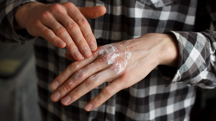 man rubbing lotion onto his hands